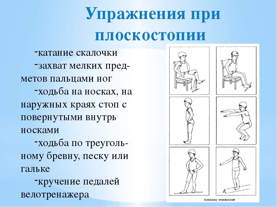 Утренняя гимнастика как предупредить плоскостопие проект